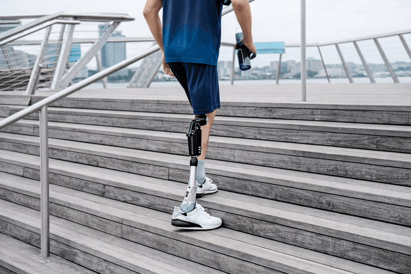 AI自發電智慧義肢平台合作計畫｜EZeeTech × NOVATERA